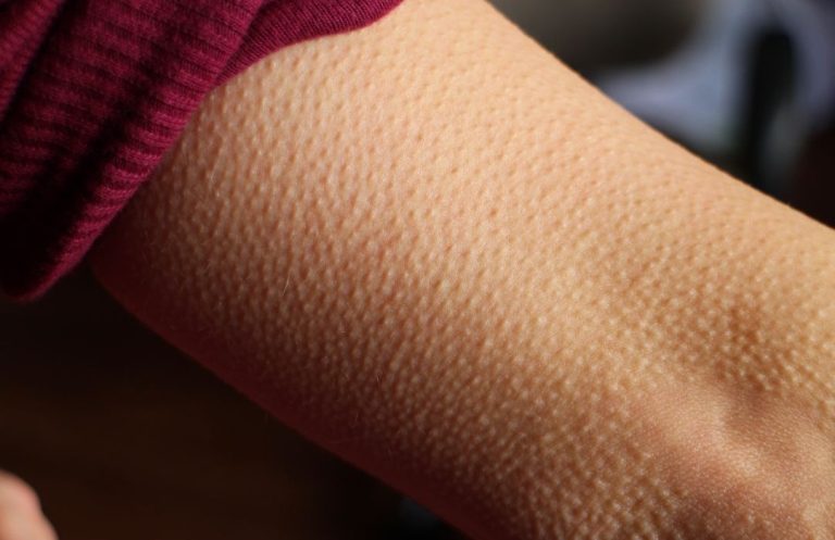 What Is Frisson? The Science Behind Why Music Gives You Chills